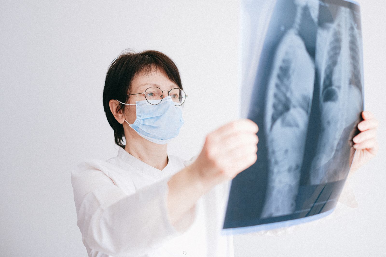 Medico che osserva una TC polmonare