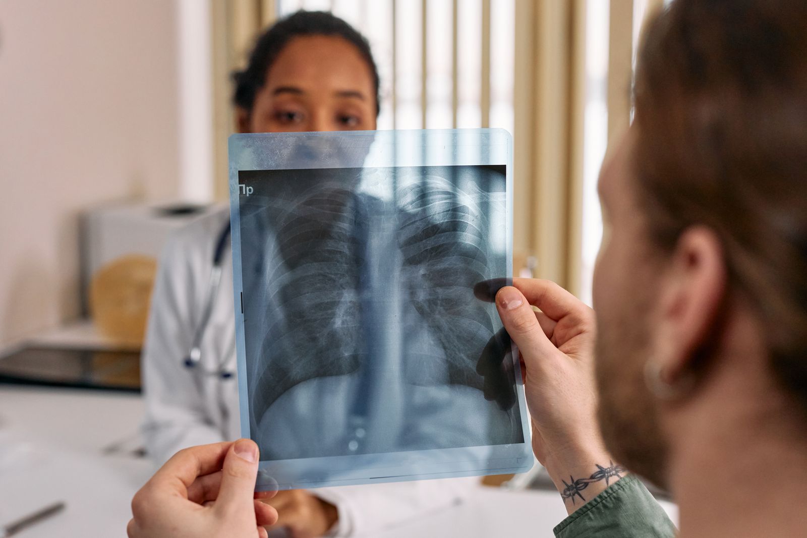 Medico che esamina una radiografia del torace
