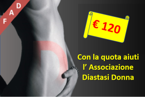 Diastasi muscoli retti