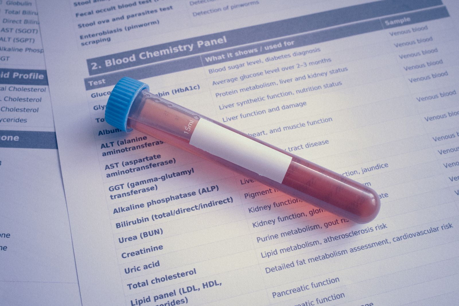 Provetta di sangue per l'analisi del colesterolo in laboratorio