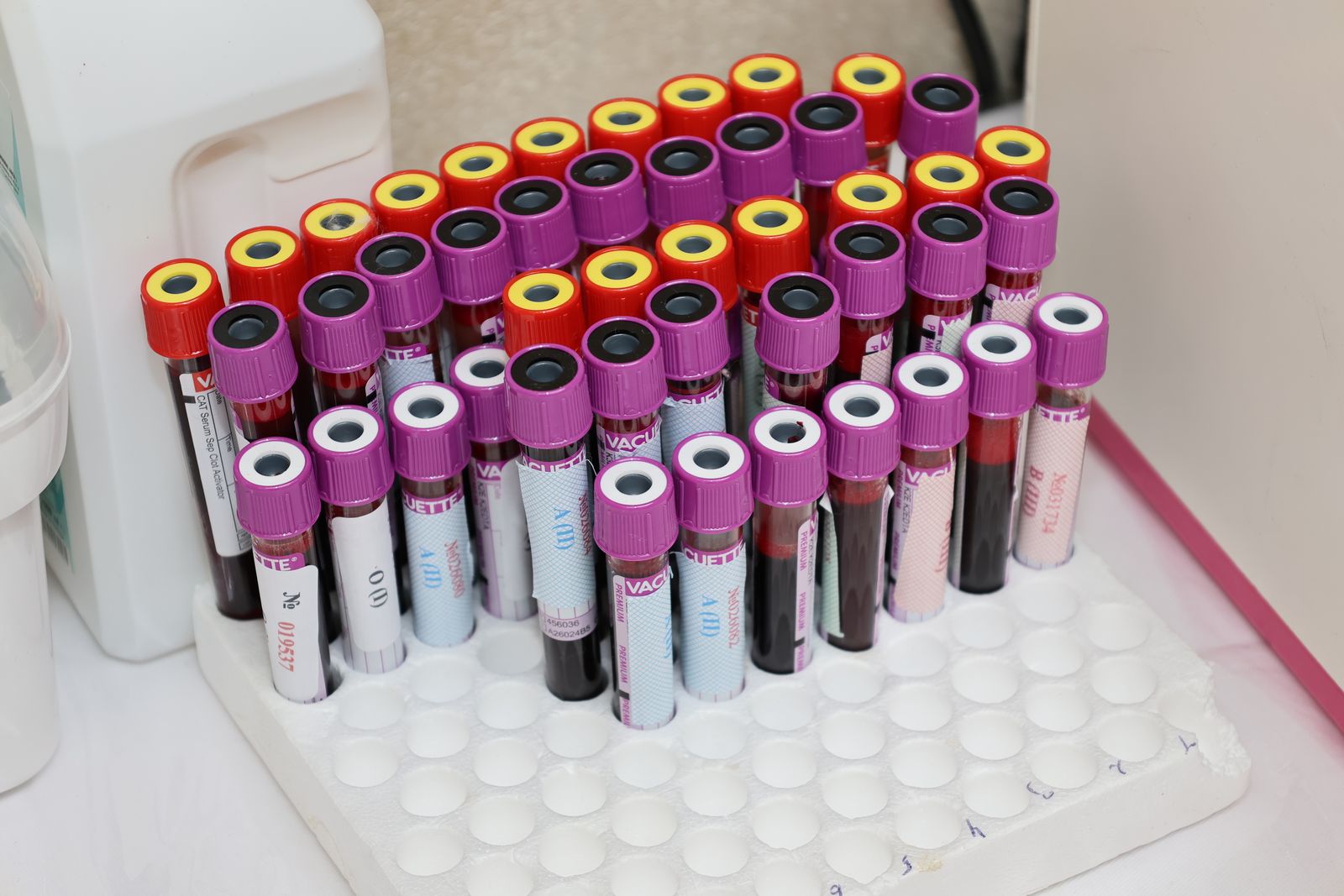 Provette per analisi del sangue in laboratorio