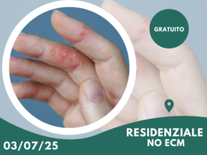 Eczema Cronico delle Mani  Verso una rete dermatologica integrata